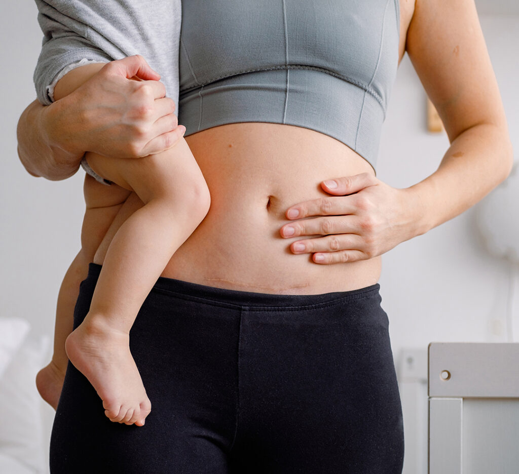 a woman holding a baby showing her imperfect body